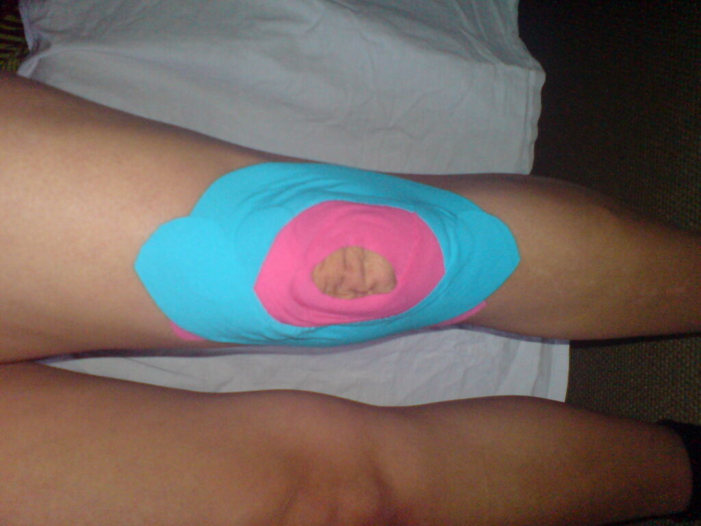 Kurs Medical- Taping Kurs Medical- Taping